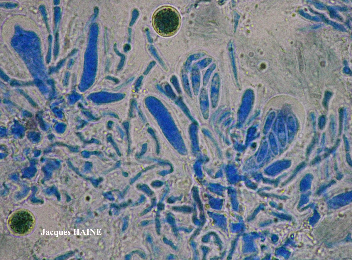Protoparmelia montagnei chemo aquilina forme de régénérescence.